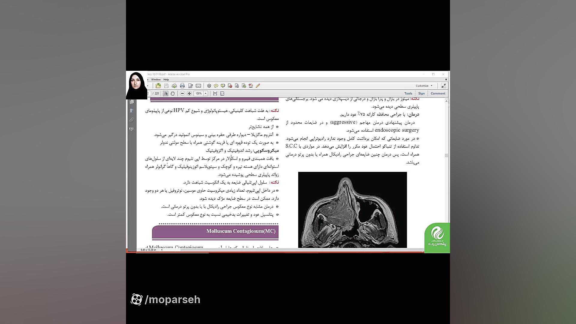 نمونه تدریس کتاب آسیب شناسی دهان و فک و صورت دندان پیش