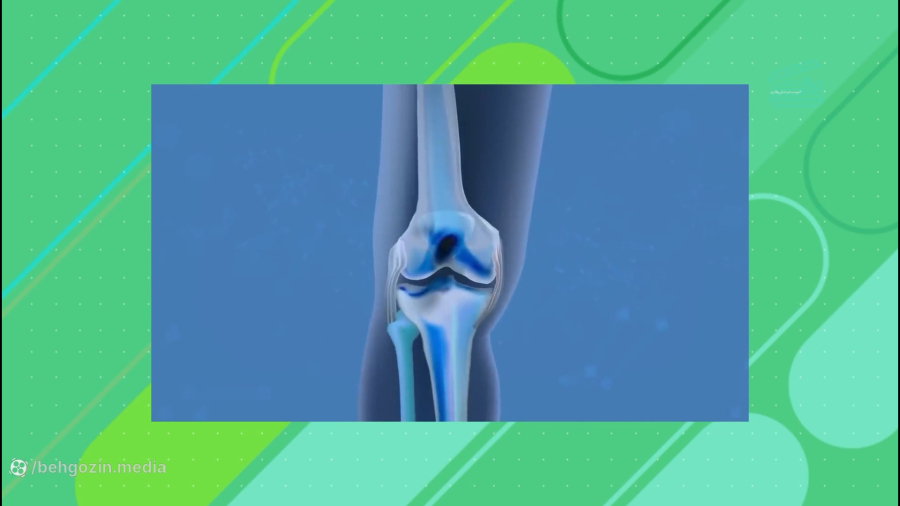 برنامه تلویزیونی سرخرگ - شبکه چهار سیما - قسمت پانزدهم