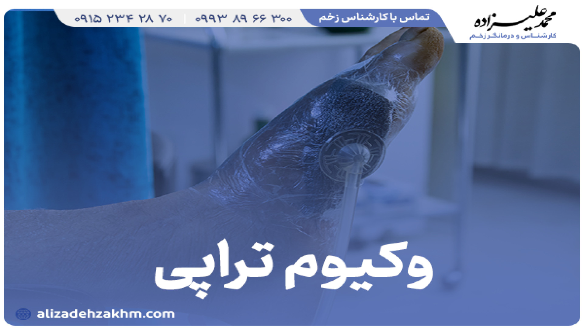 وکیوم تراپی زخم در مشهد درمانگر زخم(دکتر محمد علیزاده)