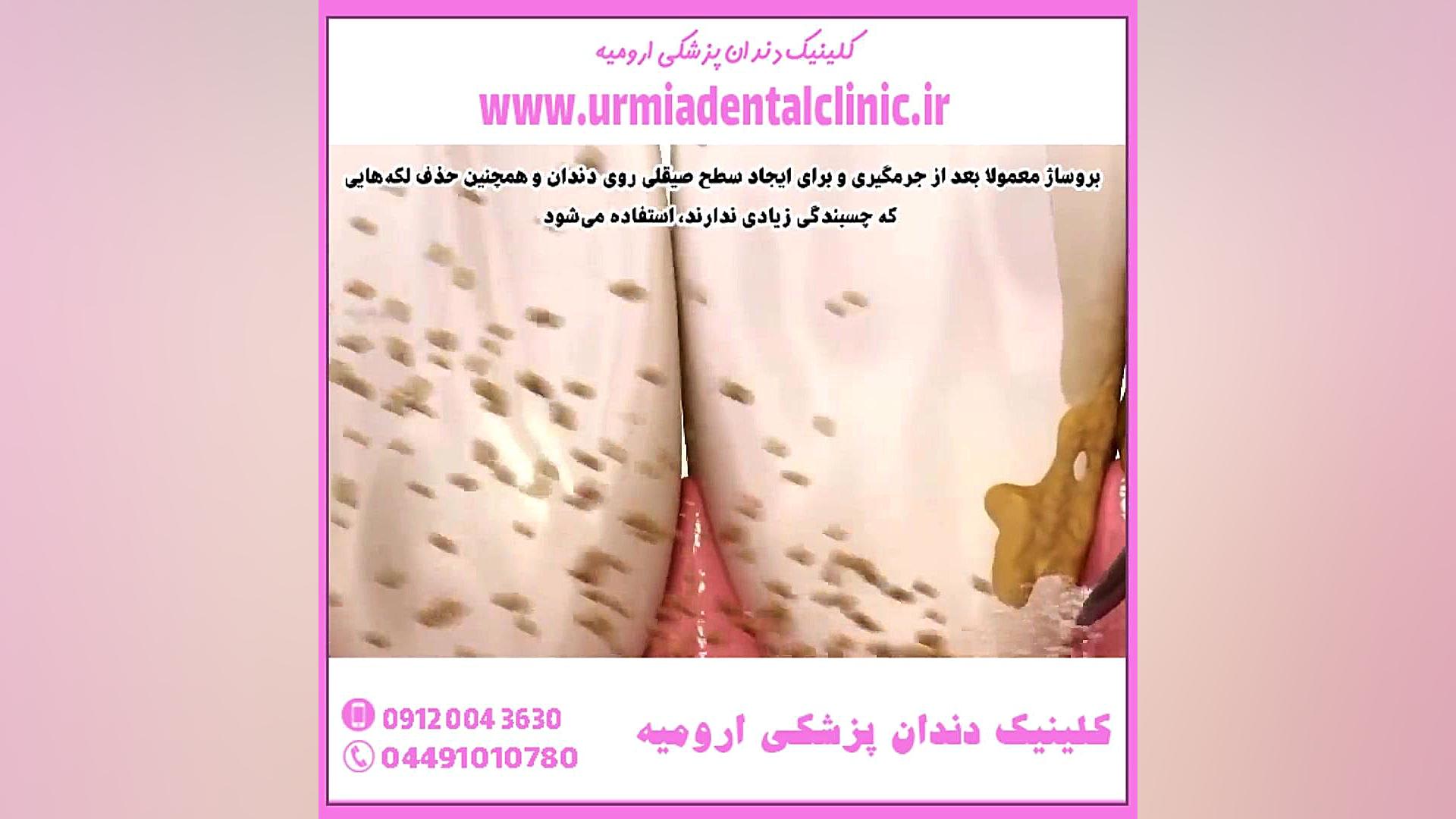 تفاوت جرمگیری و بروساژ Fluorescence Lifetime Imaging