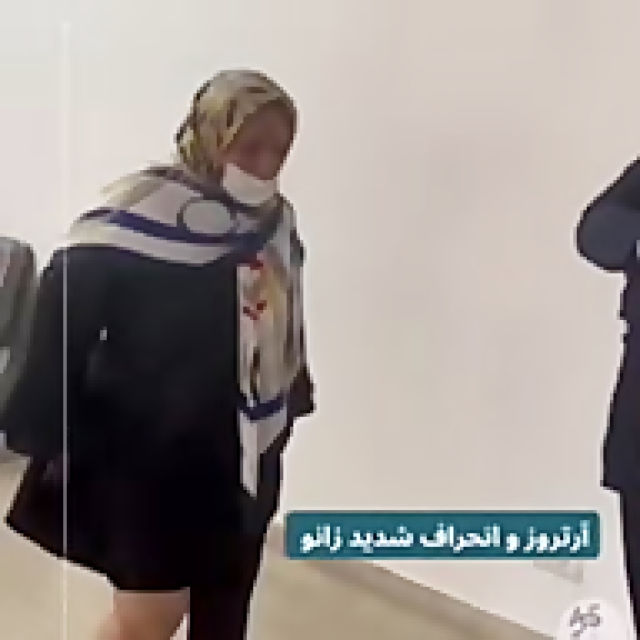 جراحی ارتروز و انحراف شدید زانو دکترعلیرضا صحرانورد متخصص استخوان و مفاصل