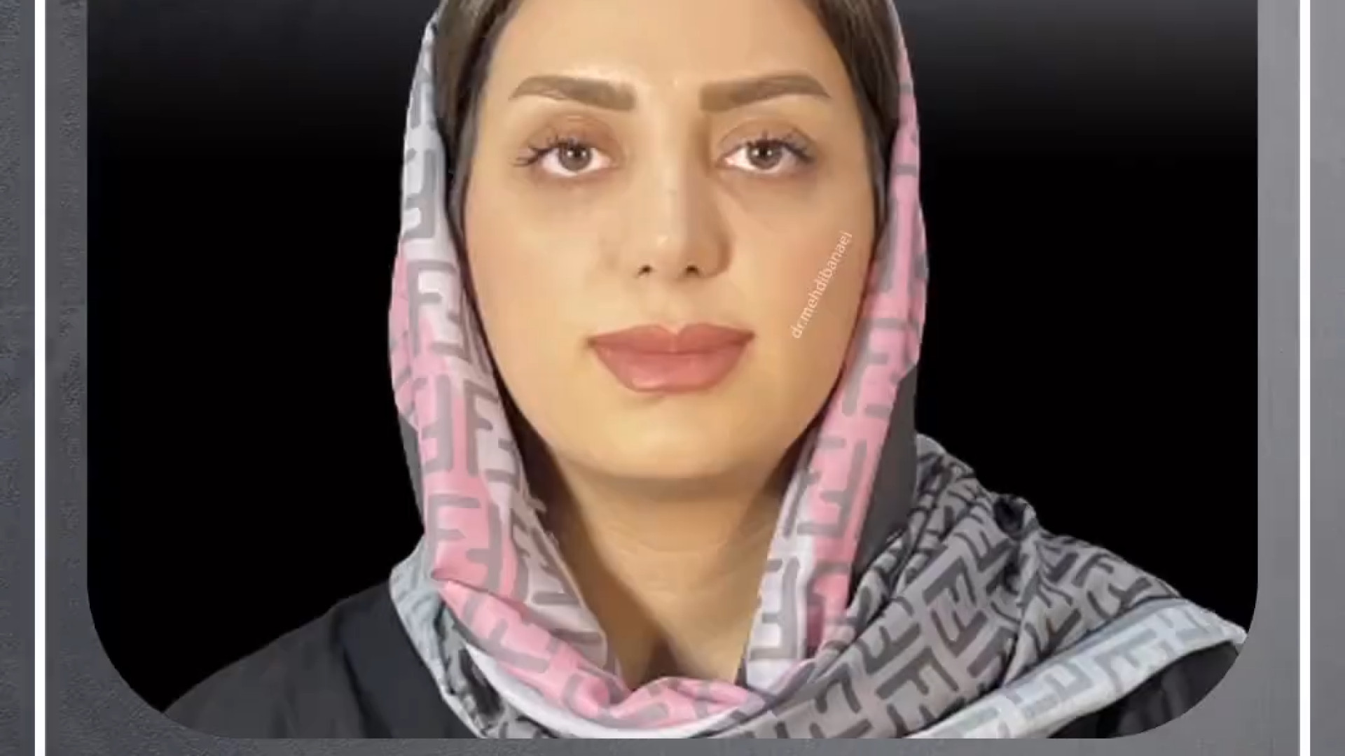 رینوپلاستی در ارومیه