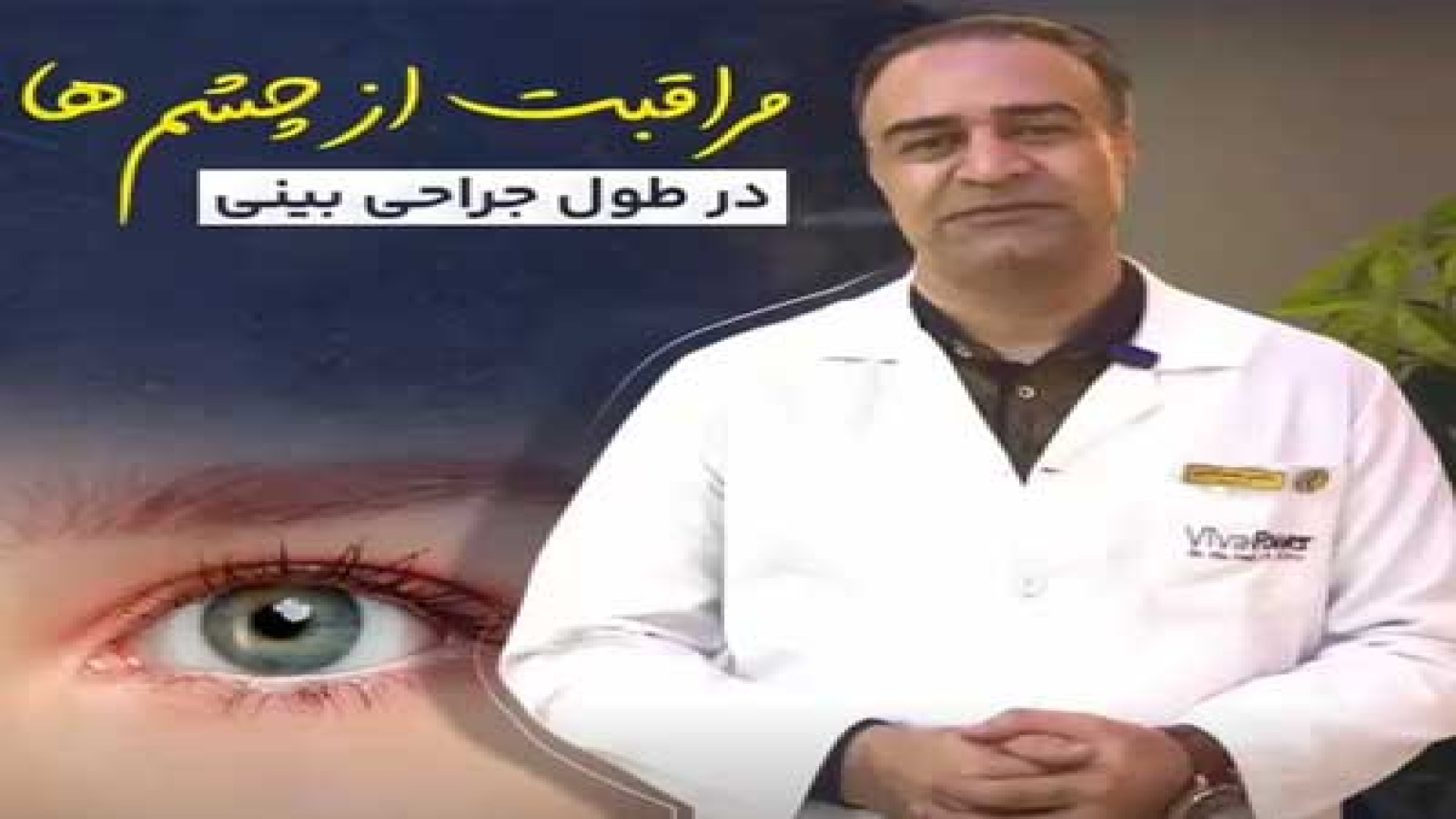 مراقبت از چشم ها در طول جراحی بینی | دکتر گلی مزوتراپی