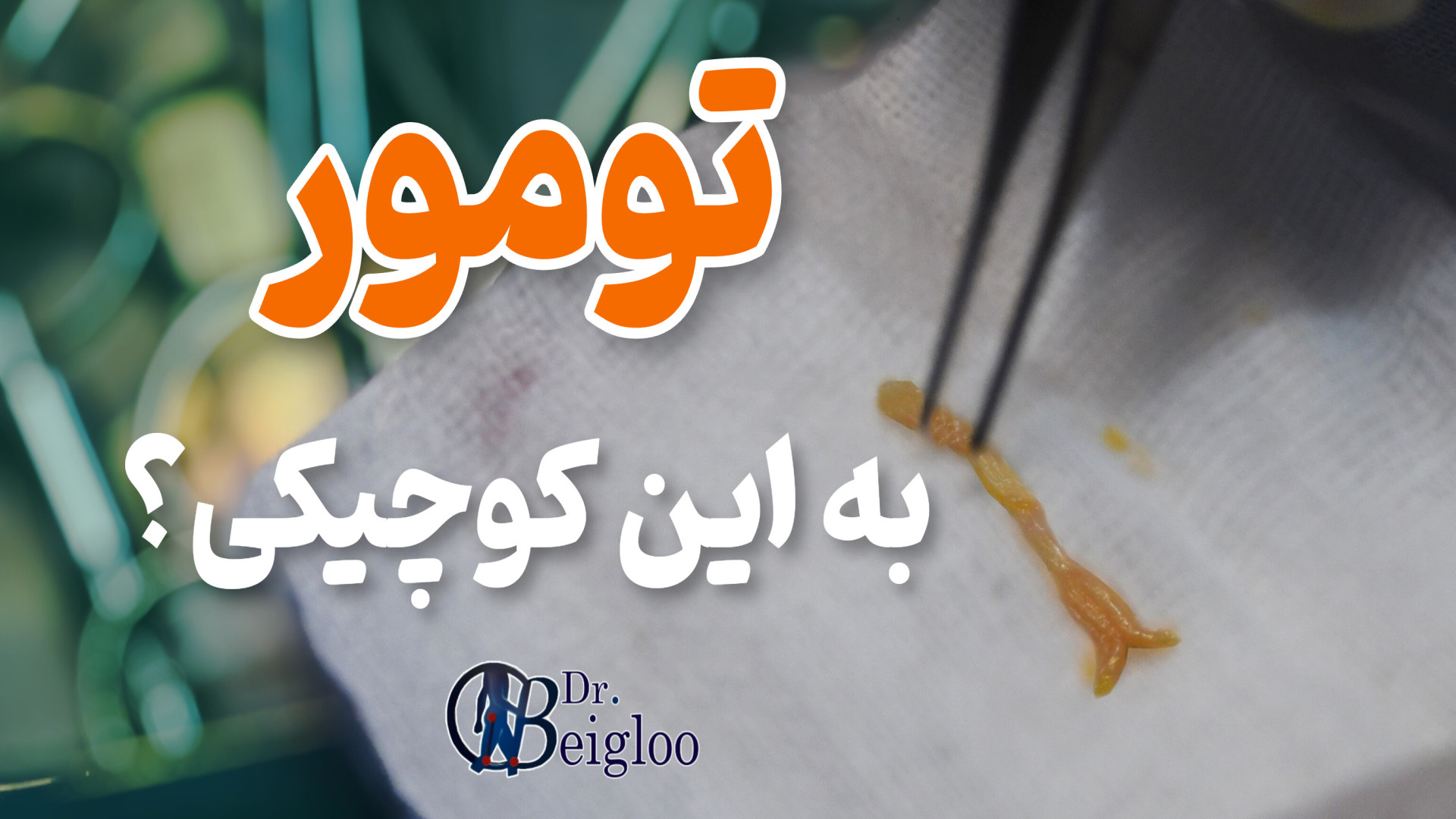 تومور عصب انگشت پا دکتر محمود جعفر بیگلو