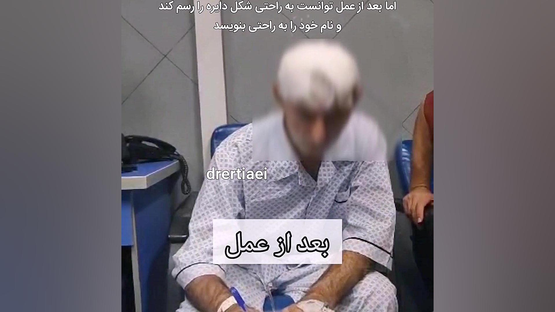 قبل و بعد جراحی پارکینسون دندان پیش