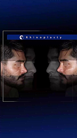 truncate dir-rtl