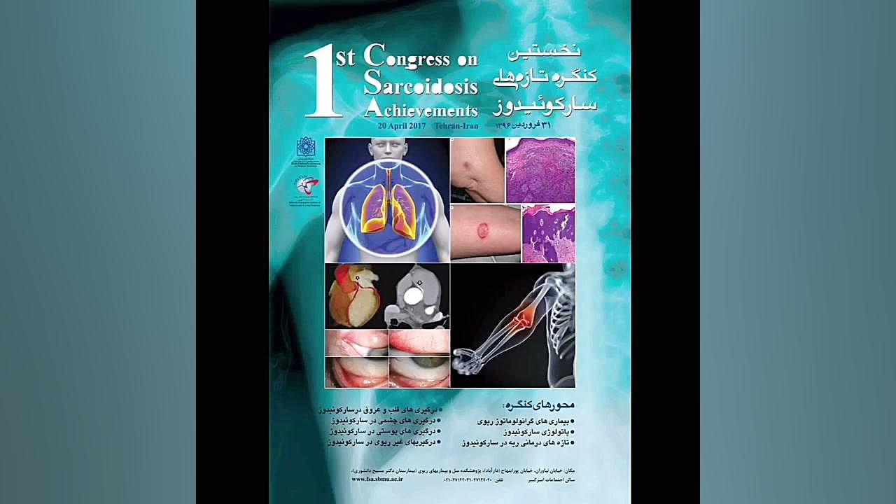 کنگره تازه های سارکوئیدوز دکتر اردا کیانی