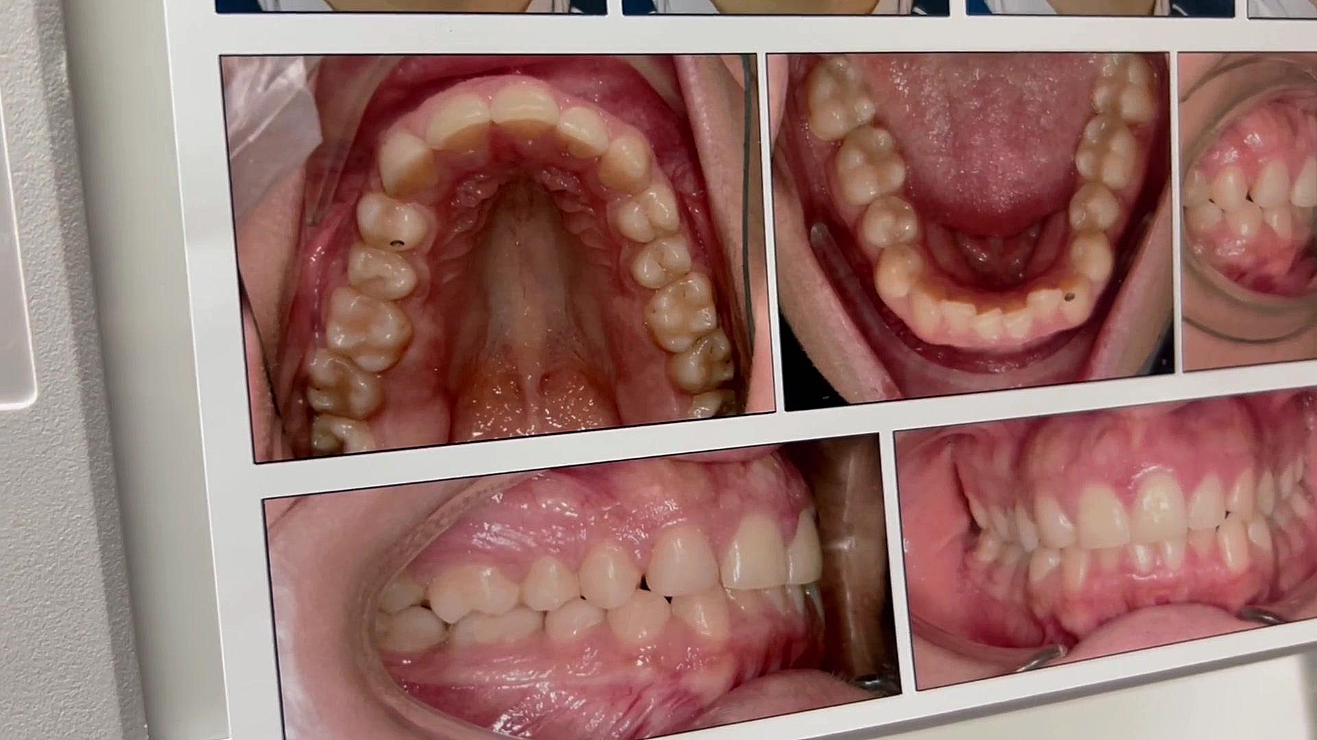 ارتودنسی تخصصی دكتر مهدي فهيمي هنزائي