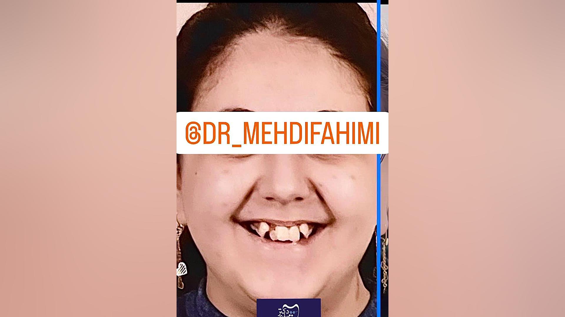 معجزه ی ارتودنسی دكتر مهدي فهيمي هنزائي