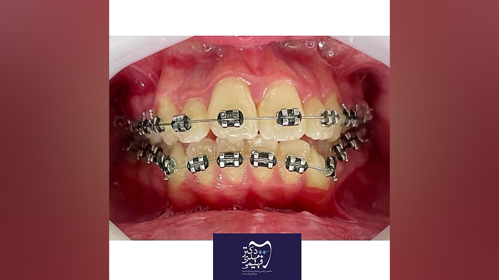 معجزه ی ارتودنسی دکتر مهدی فهیمی دكتر مهدي فهيمي هنزائي