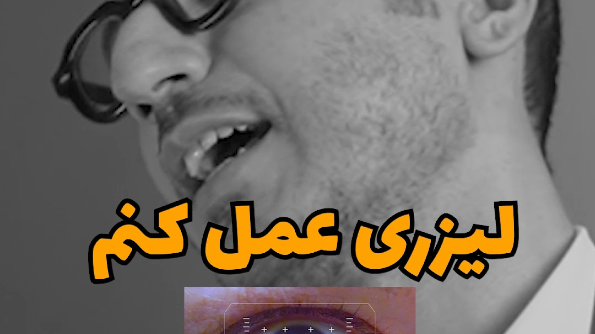 لیزری عمل کردن آب مروارید ممکنه؟؟ برداشتن خال گوشتی