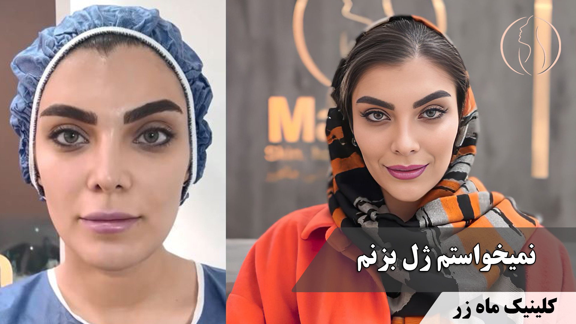 نمیخواستم ژل بزنم ( کلینیک زیبایی ماه زر ) پزشکی درد مداوم