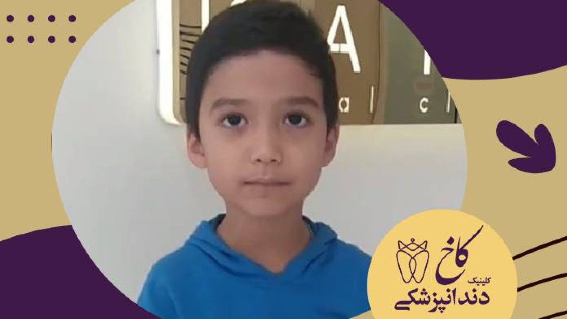 گل پسرمون بعد درمان ریشه دندان دائمی اش کلینیک دندانپزشکی کاخ