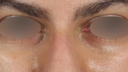 truncate dir-rtl