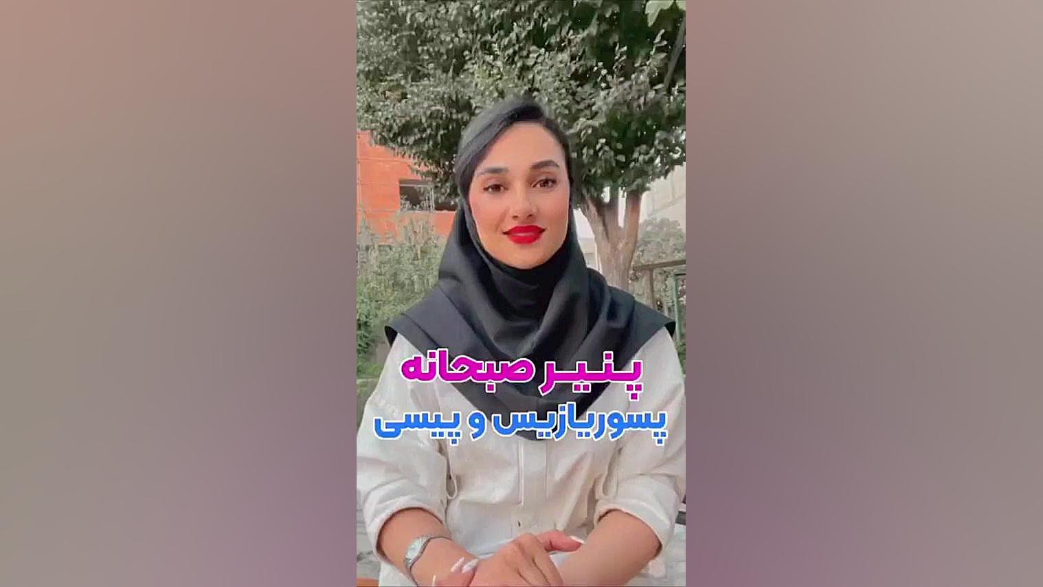 پنیر صبحونه پسوریازیس و ویتیلیگو چی باید باشه؟ شکیرا
