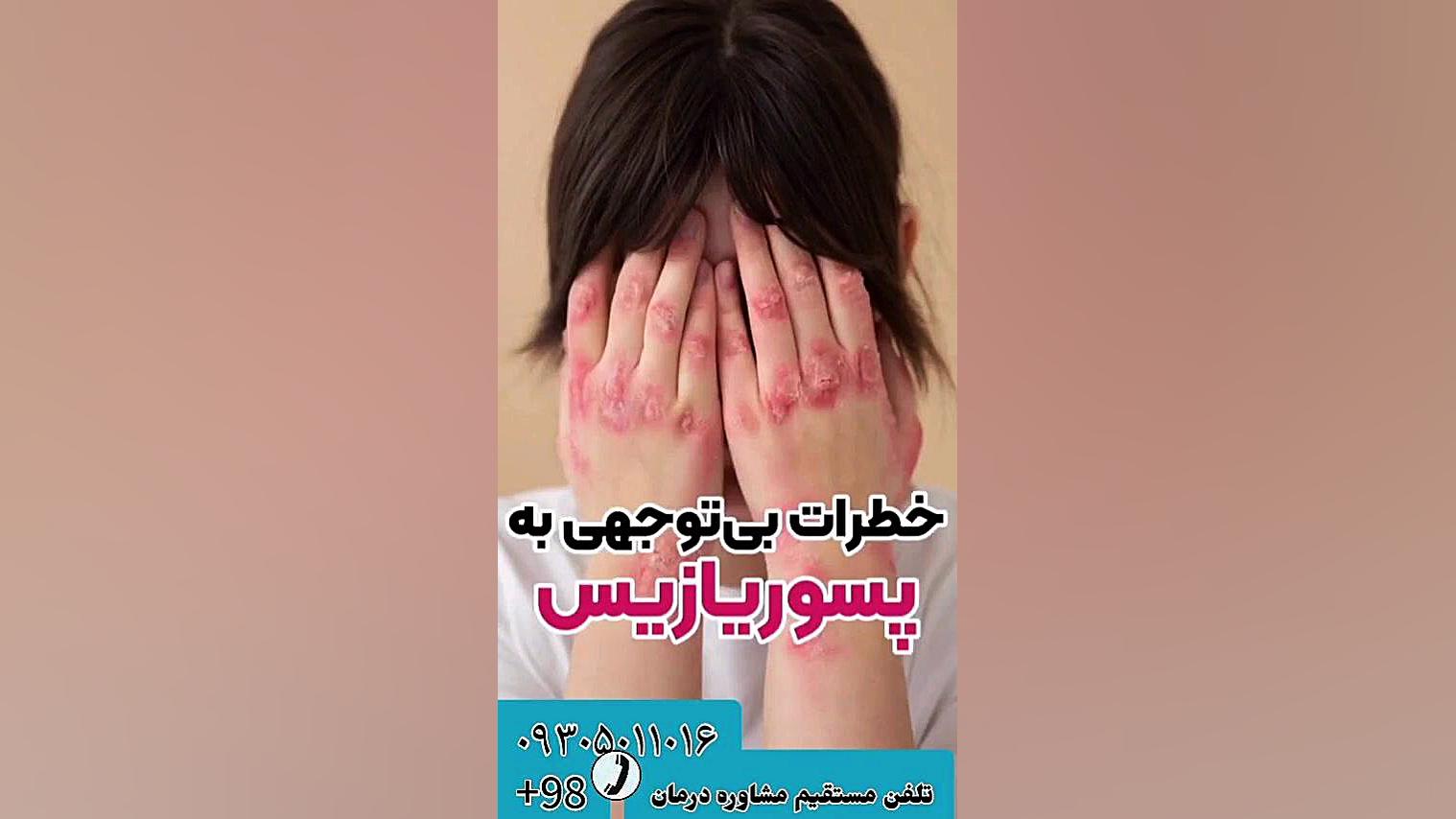 خطرات بی توجهی به پسوریازیس Psoriasis صدف پوستی علیرضا قربانی