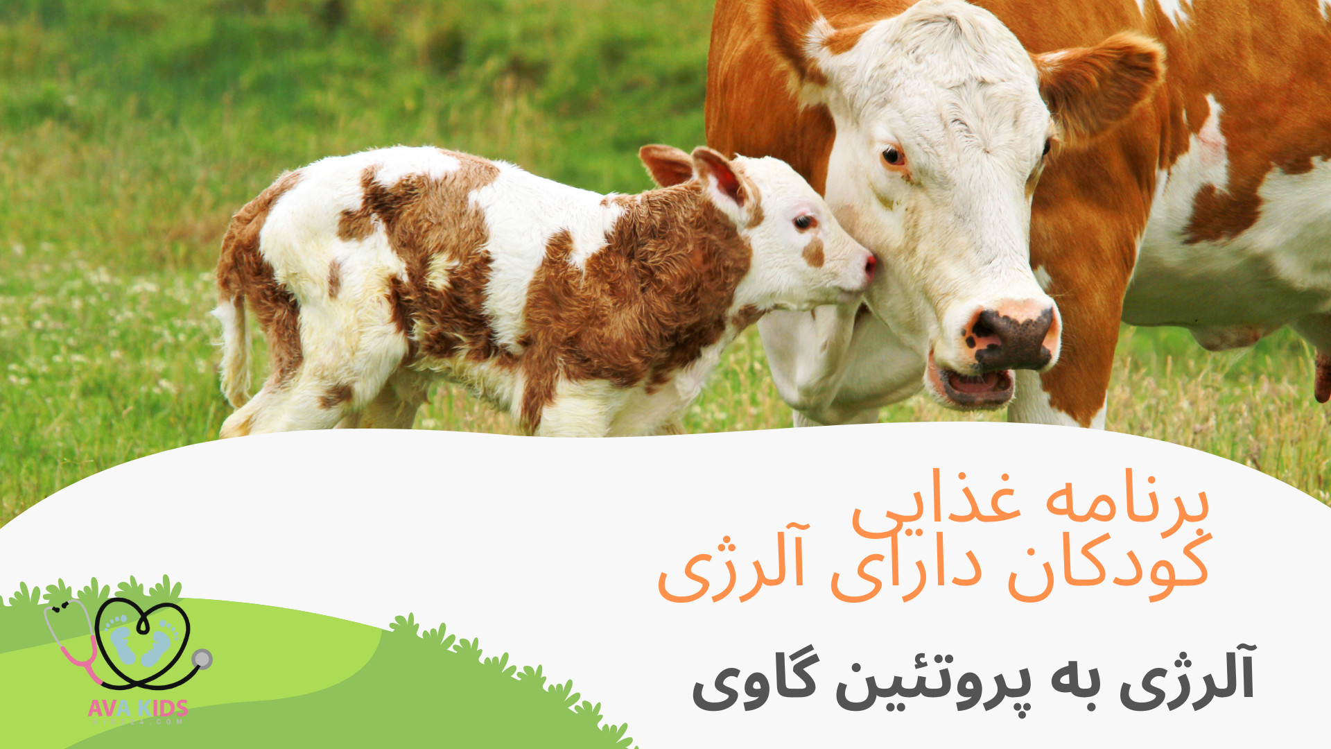 آلرژی به پروتئین گاوی در کودکان جراحی پف زیر چشم