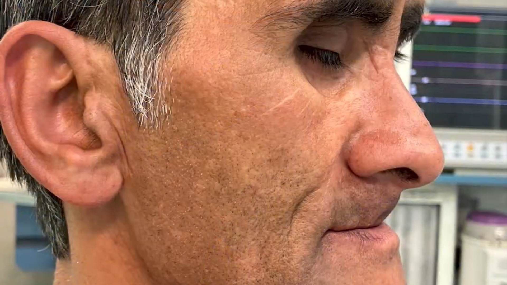 جراحی زیبایی صورت با ترمیم استخوان دکتر حمید رضا فتحی فوق تخصص جراحی پلاستیک