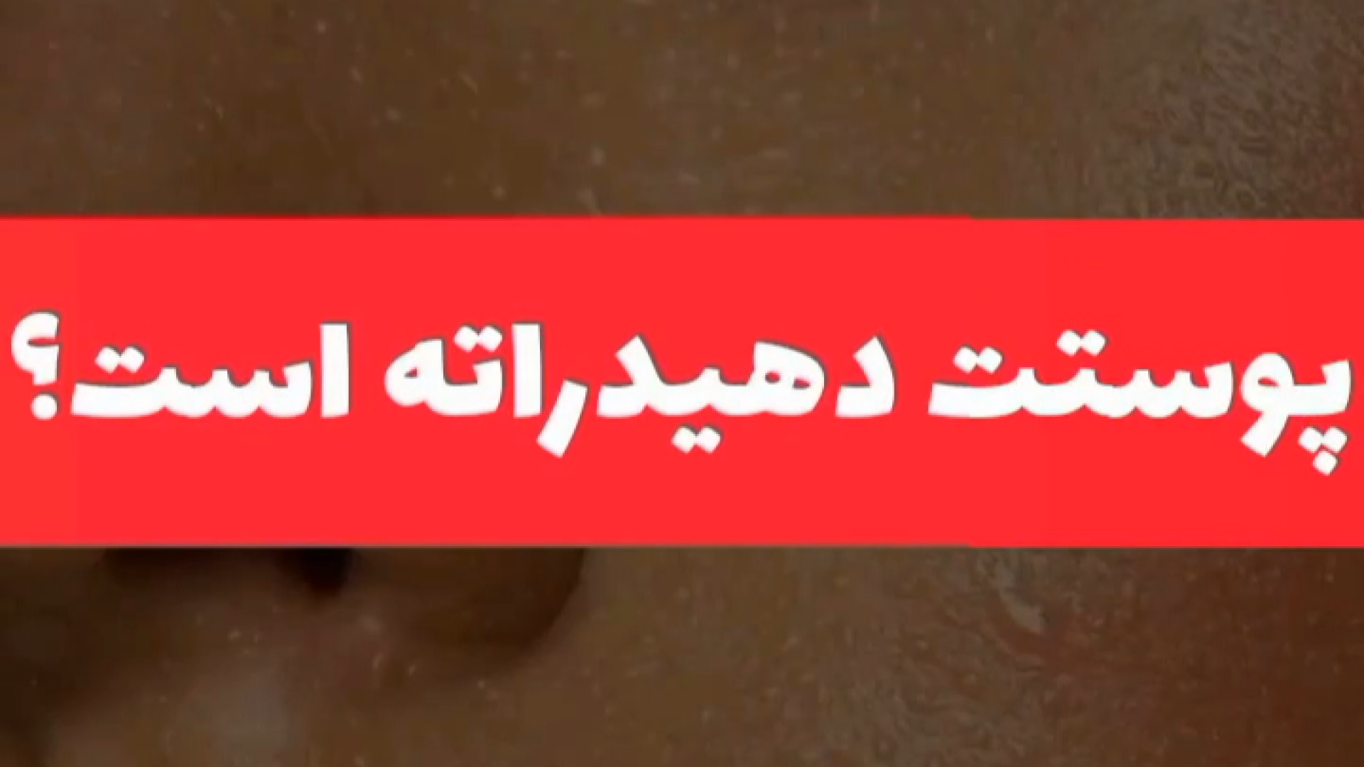 درمان پوست دهیدراته دکتر امیر سلیمانی