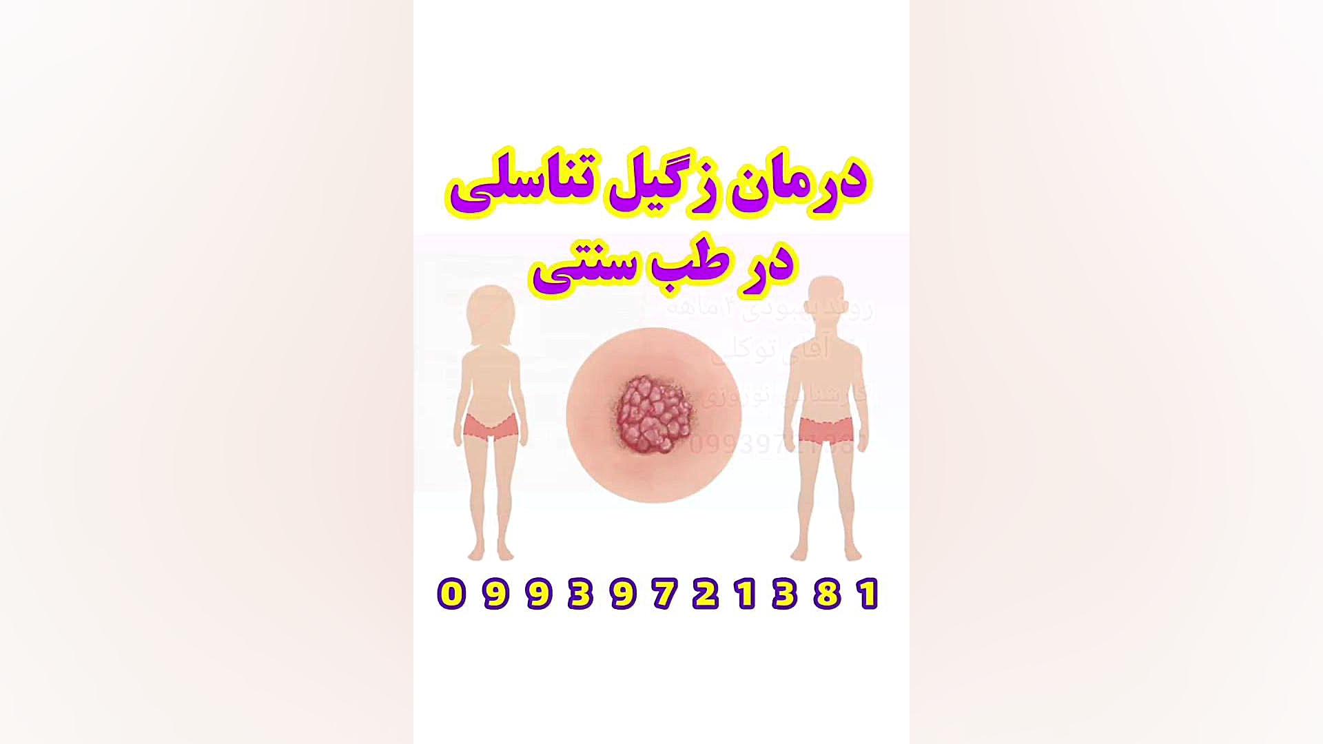 ارتباط زگیل با سرطان پوست موش کنگره