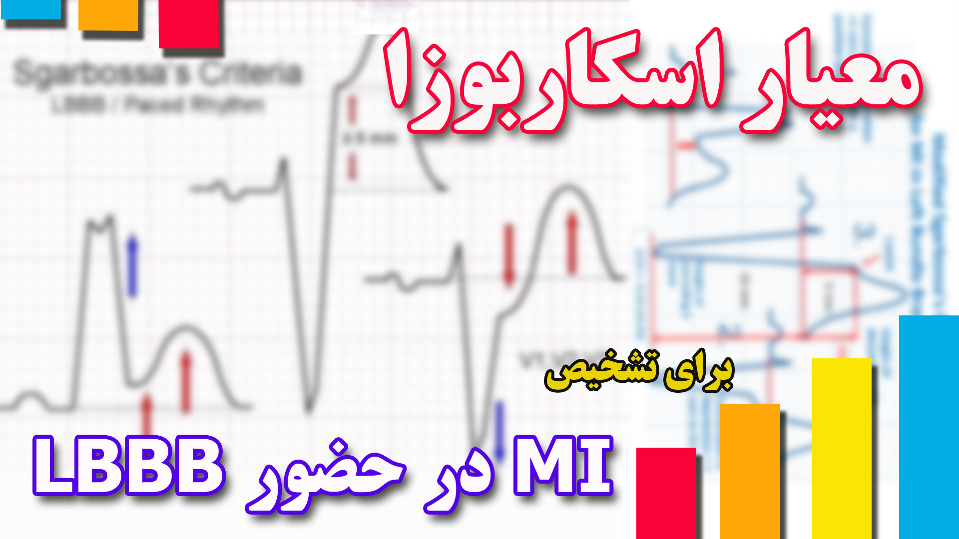 معیار اسکاربوزا و اسمیت تشخیص سکته قلبی در حضور LBBB در تفسیر نوار قلب ECG کربوکسی تراپی