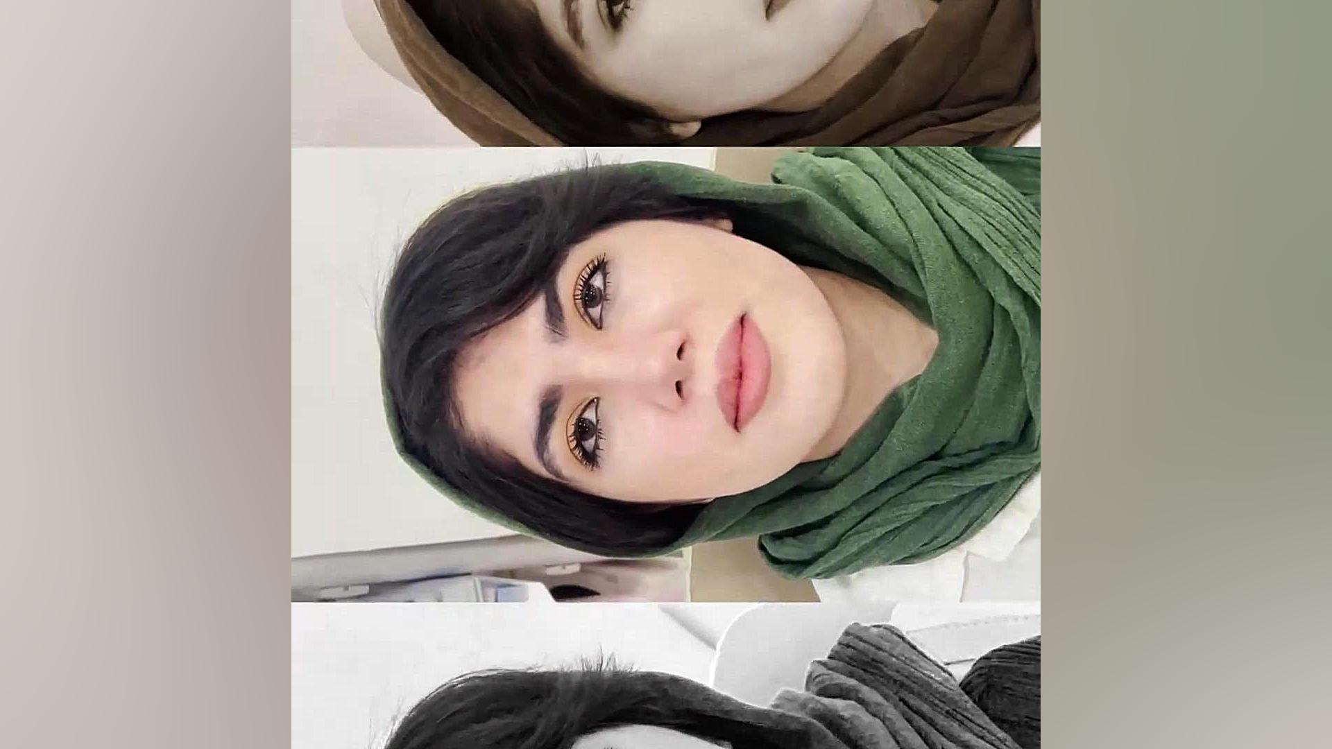 جراحی زیبایی بینی