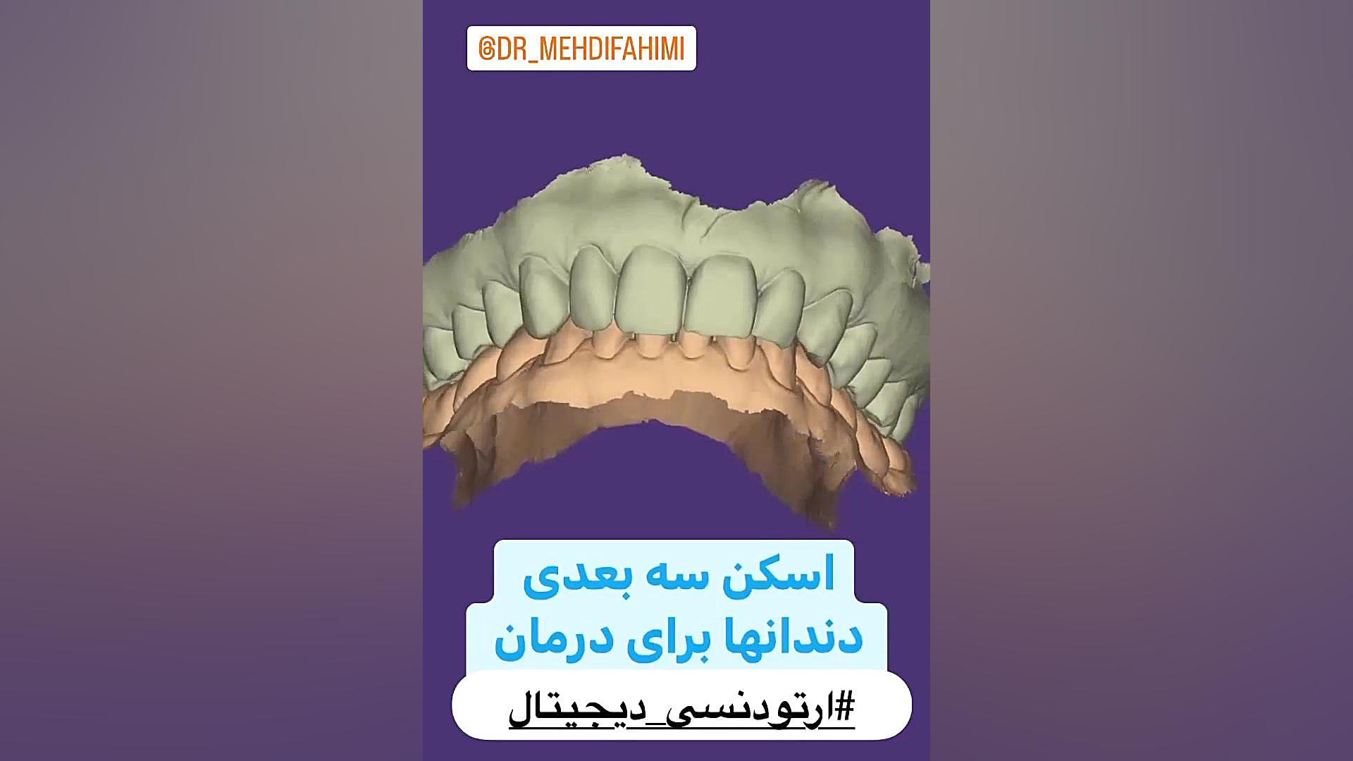 اسکن ارتودنسی دكتر مهدي فهيمي هنزائي