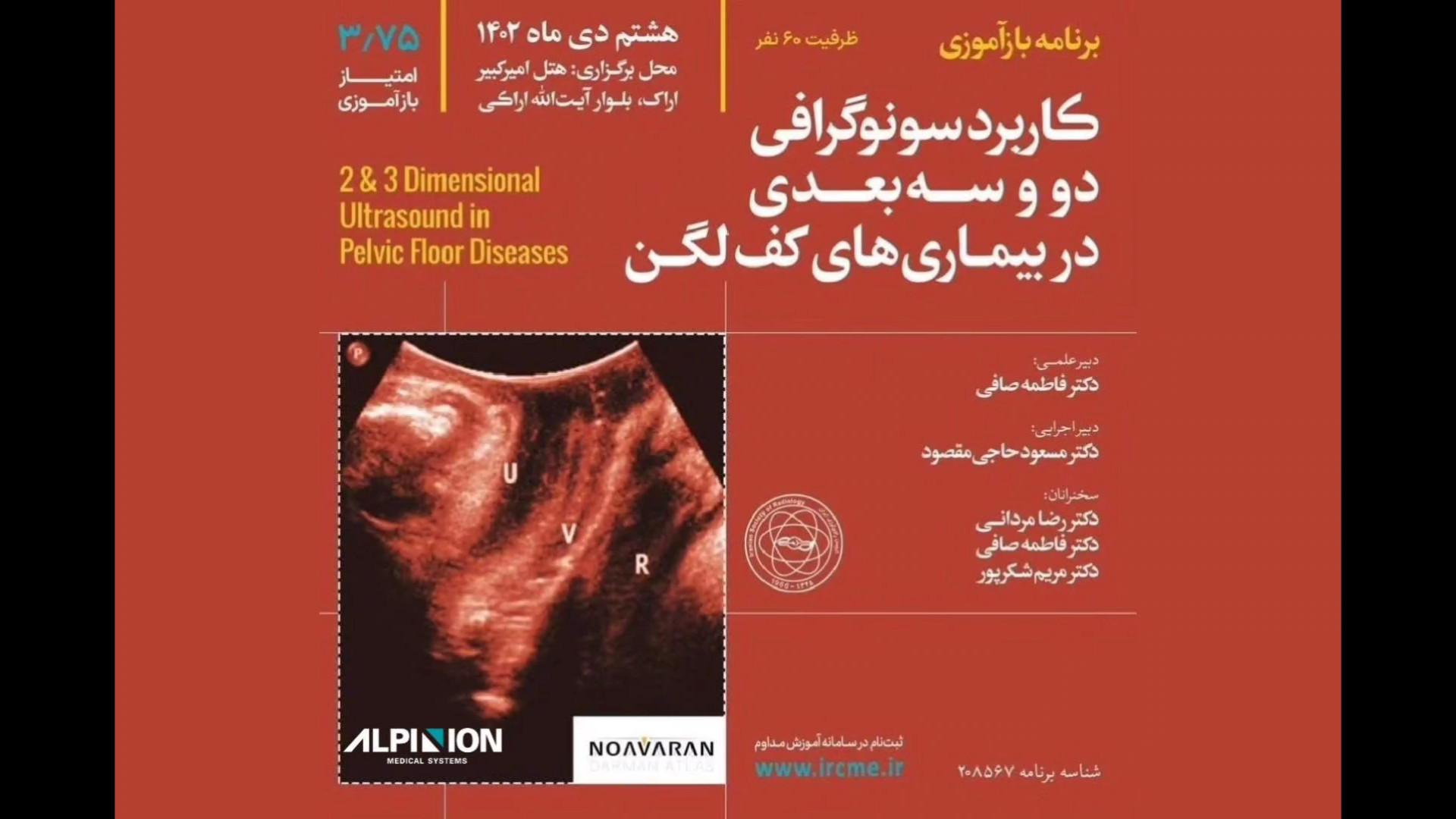 سمینار علمی کاربرد سونوگرافی سه بعدی در بیماری های کف لگن الناز شاکردوست