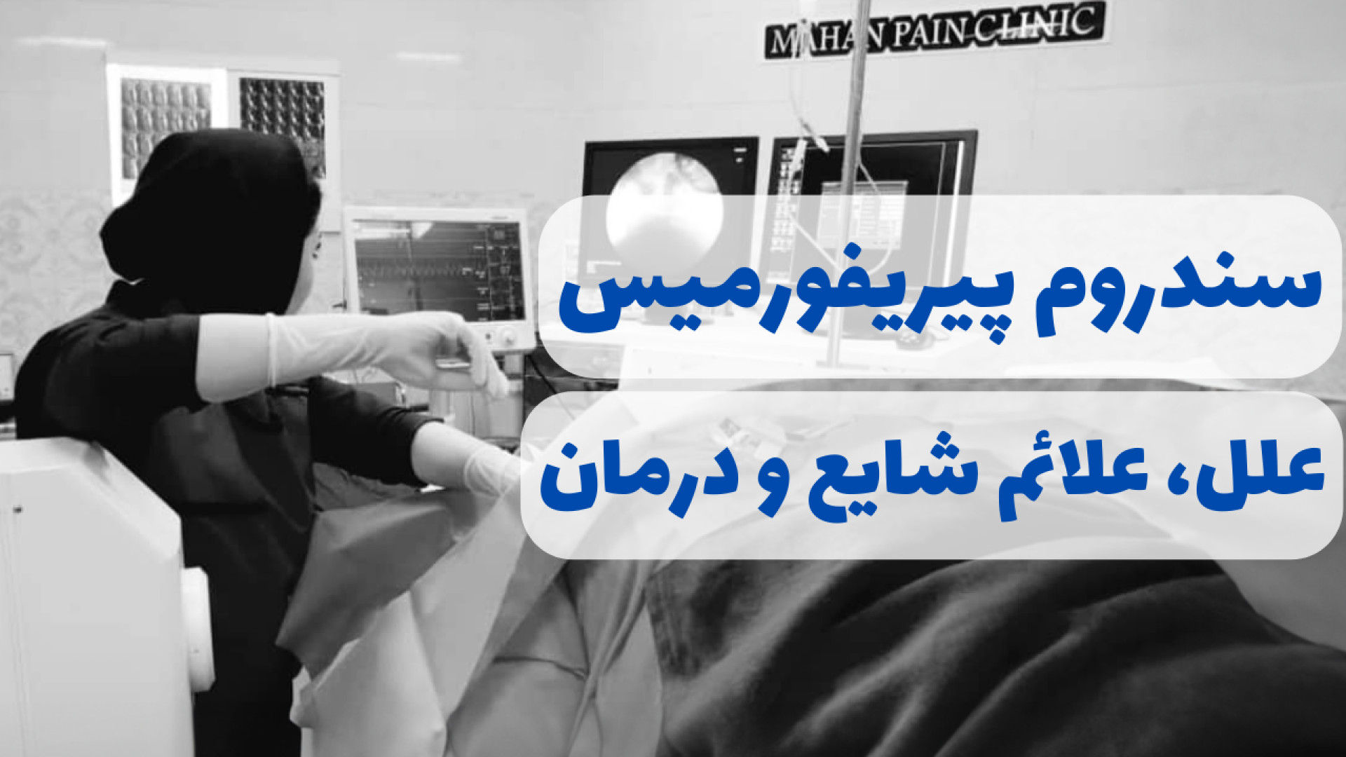 تشخیص و درمان سندرم پیریفورمیس تست تحریک ACTH