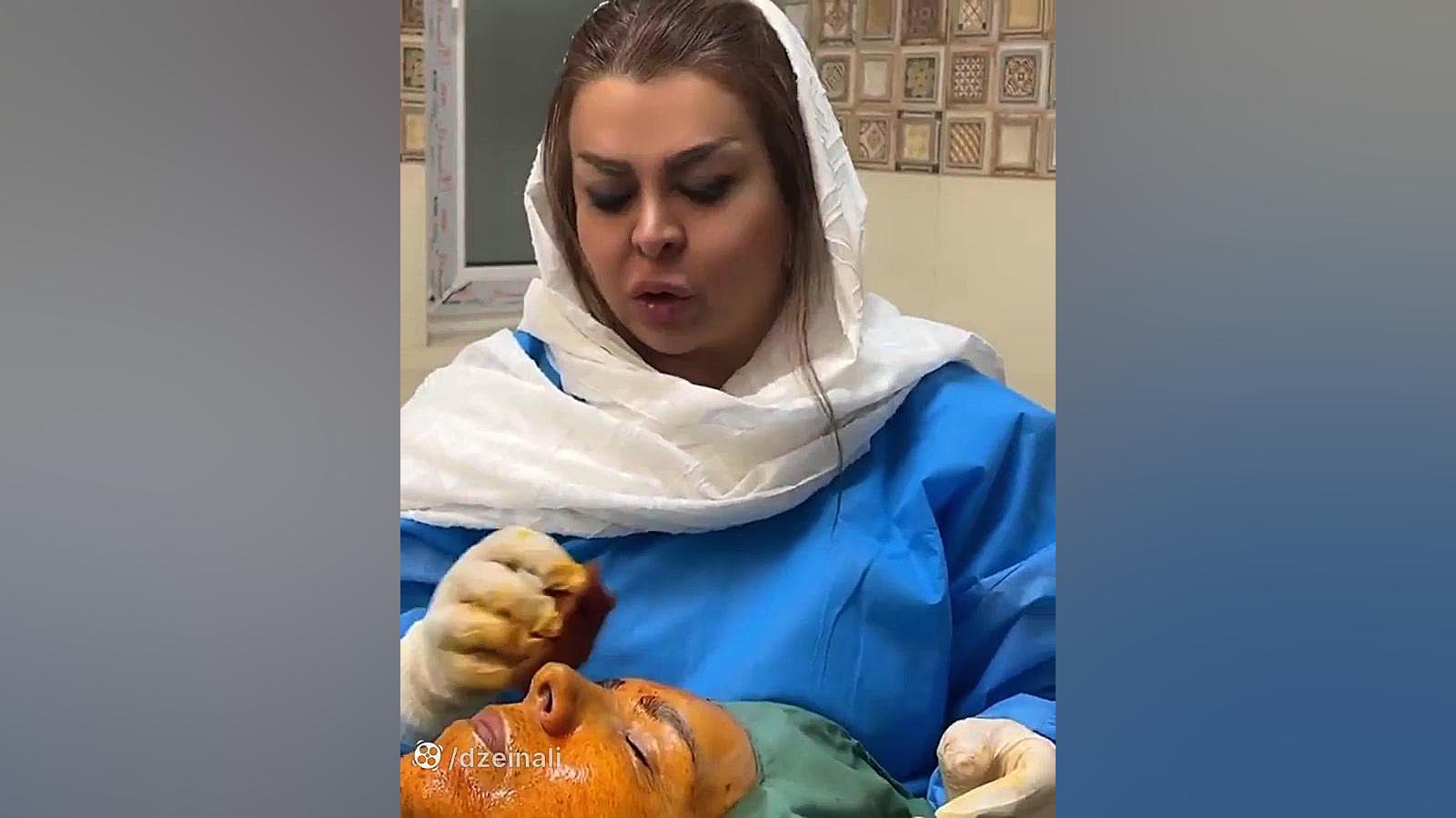 تزریق چربی به گونه و خط خنده دکتر فرحناز زینعلی - متخصص پوست، مو، زیبایی زنجان