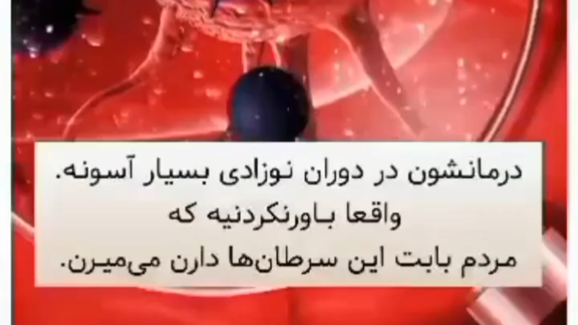 سرطان پروستات در آقایان اندودنتیکس