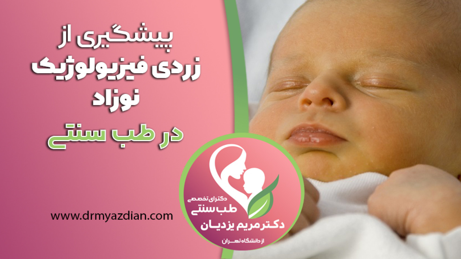 پیشگیری از زردی فیزیولوژیک نوزاد در طب سنتی پیلینگ شیمیایی