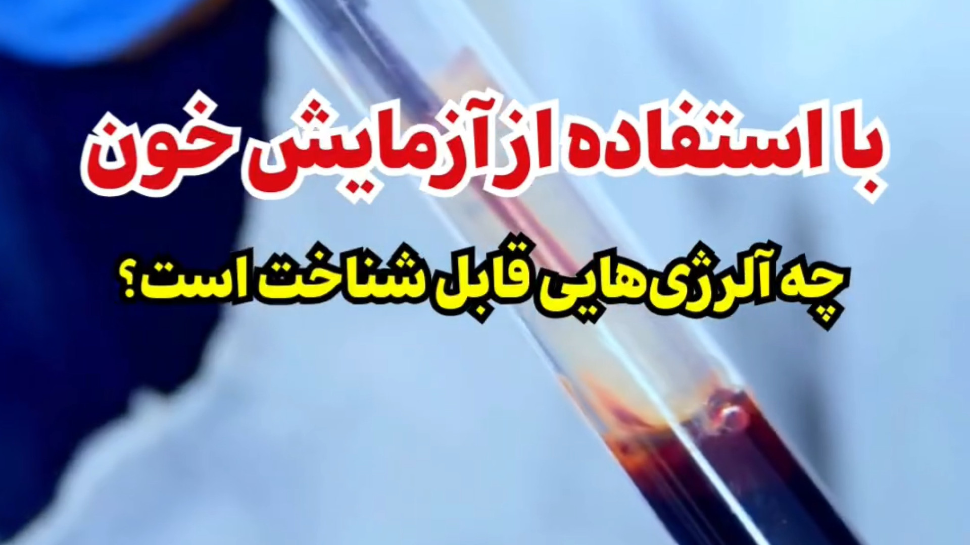 تشخیص آلرژی با آزمایش خون دکتر شهرام سیدی متخصص آلرژی و ایمونولوژی
