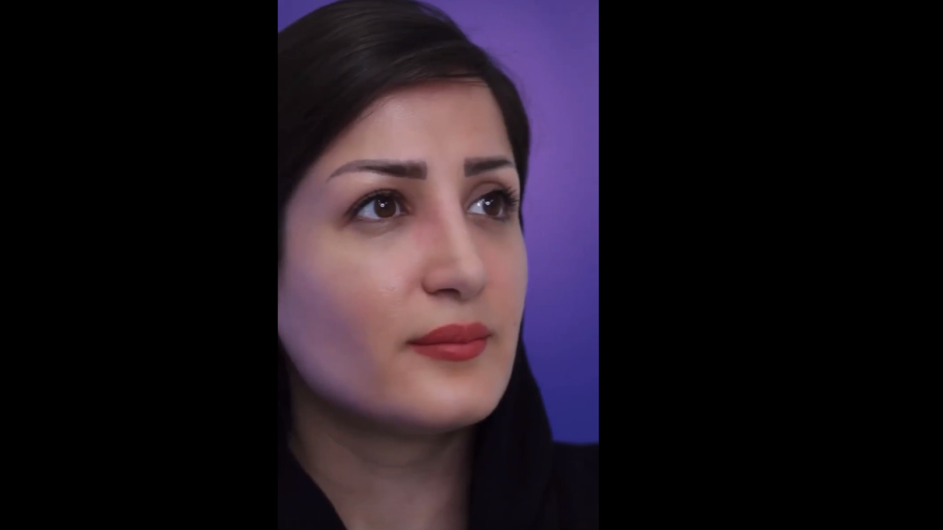 رضایت مراجعه کننده عزیز از نتیجه عمل بینی - 2 ماه پس از جراحی دکتر محمد مجیدی - جراحی بینی به سبک طبیعی شیک