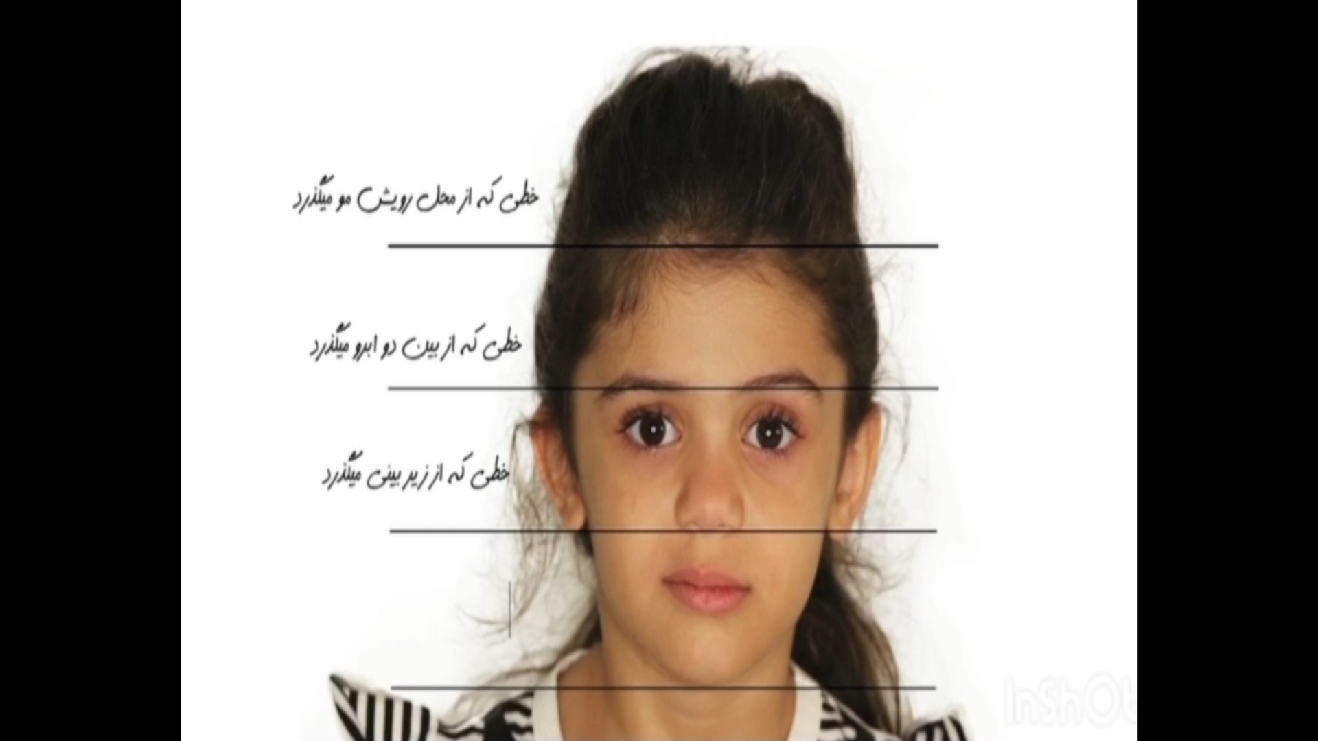 آیا دندانهای کودک شما نیاز به ارتودنسی دارد؟ دکتر زهرا قربانی