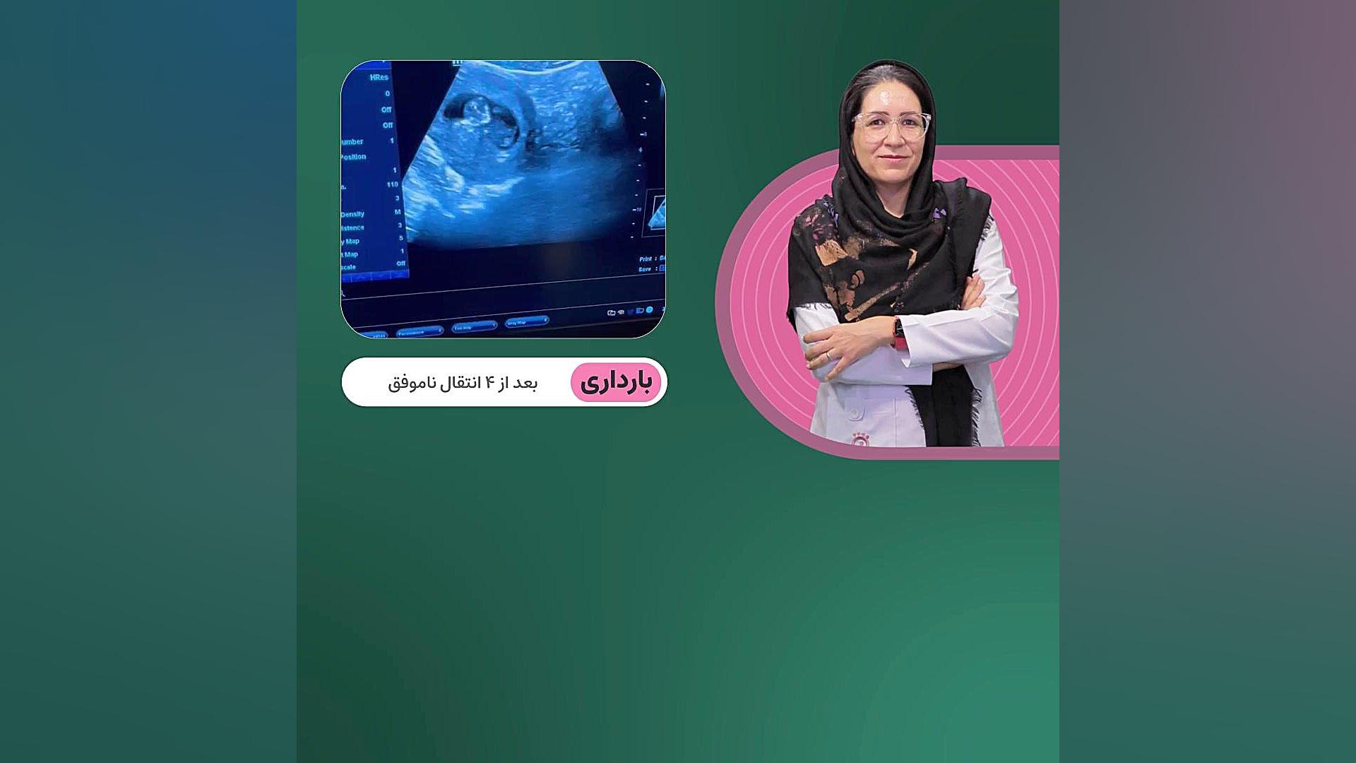 بارداری بعد از 4 انتقال ناموفق پوسیدگی دندان