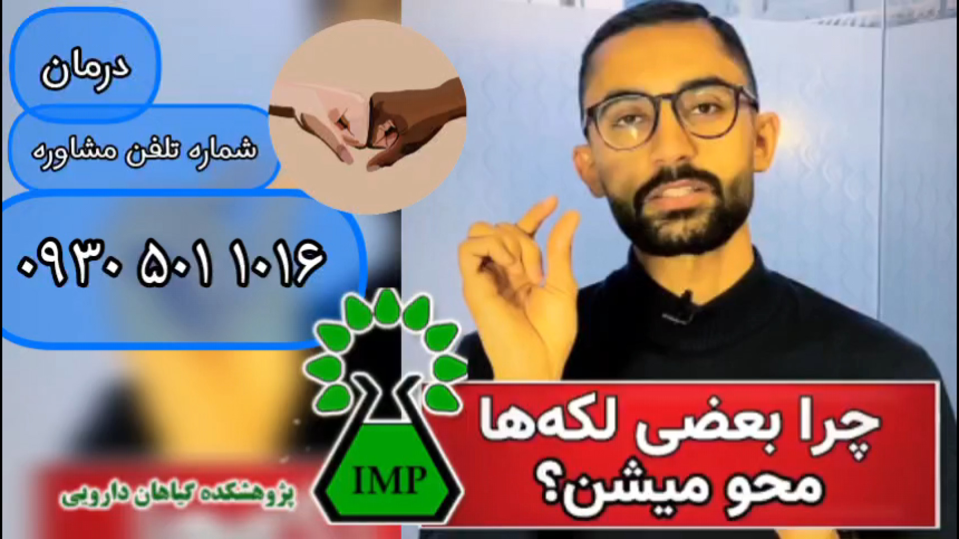 چرا لکه های ویتیلیگو خودشون درمان میشن؟ پیسی برص بهاق vitiligo اتوپلاستی