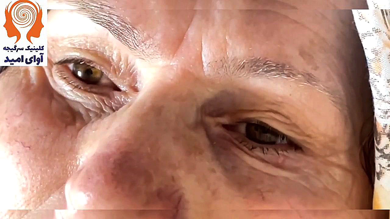 تست سرگیجه کیهان کلهر