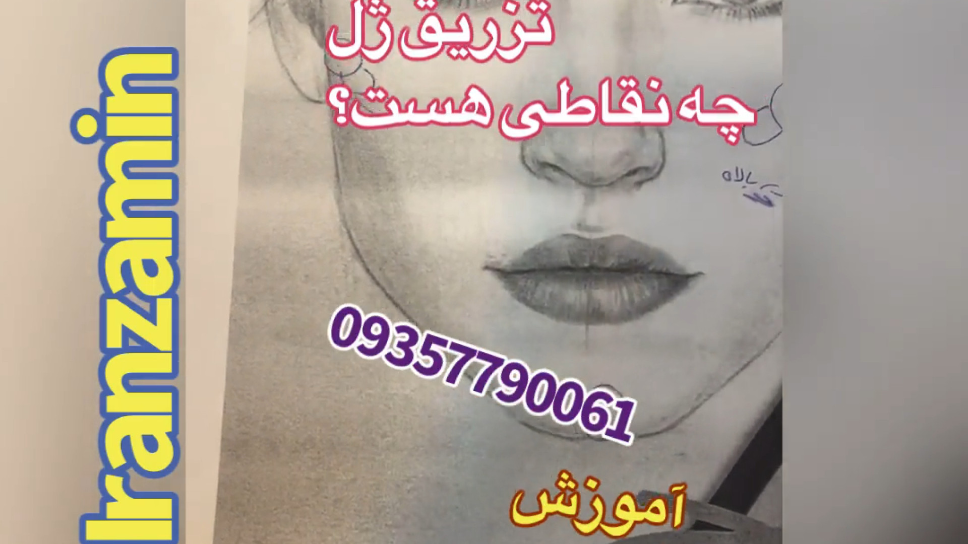 آموزس تزریق ژل آموزش نقاط ممنوعه تزریق ایران زمین 09357790061 پلاستیک لثه