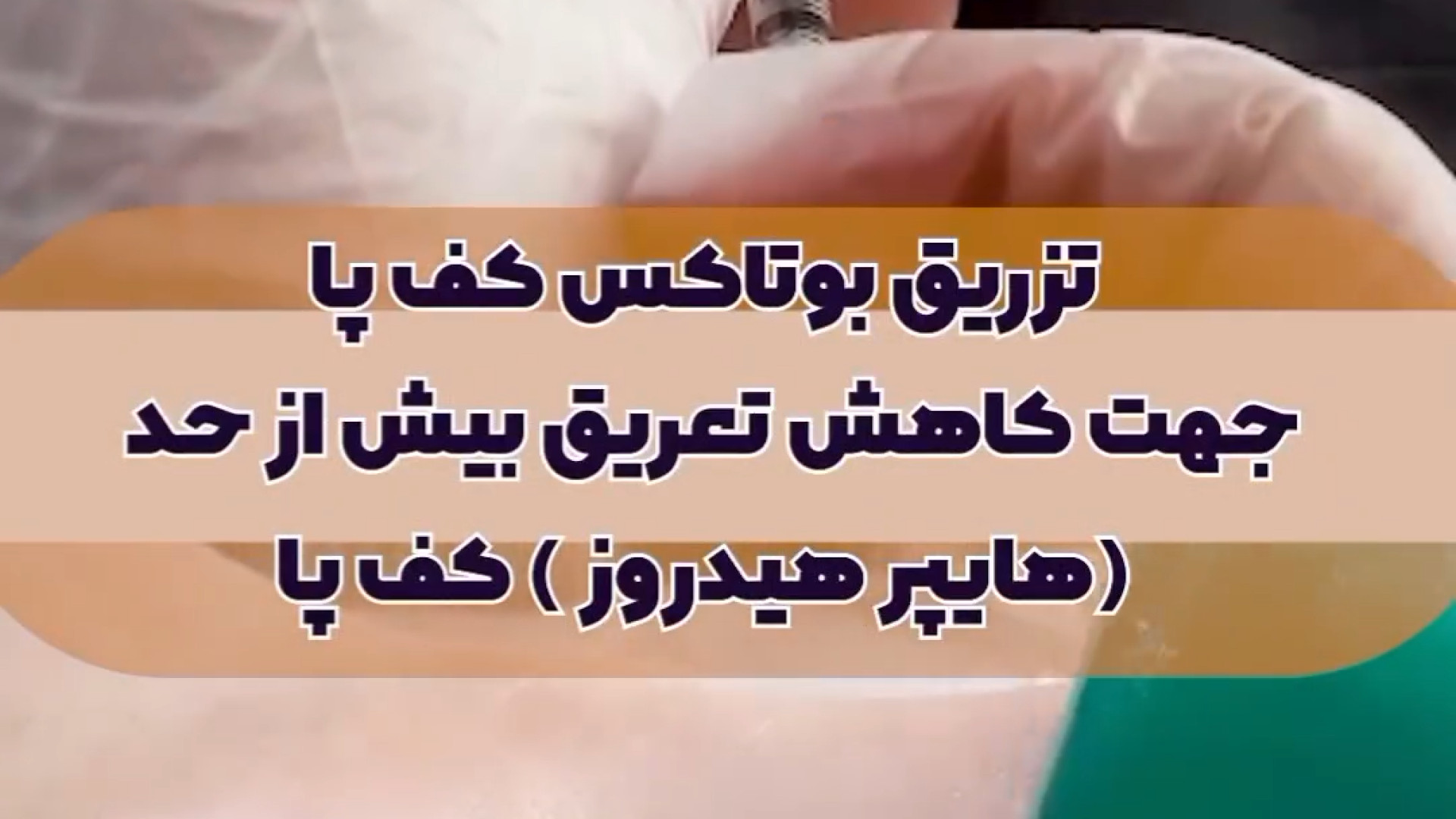 تزریق بوتاکس کف پا جهت کاهش تعریق بیش از حد دکتر حمیده آقایی