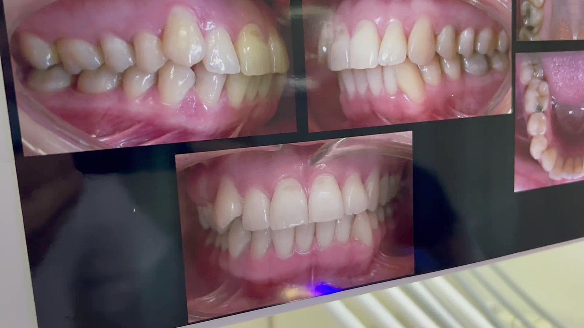 ارتودنسی تهران دكتر مهدي فهيمي هنزائي