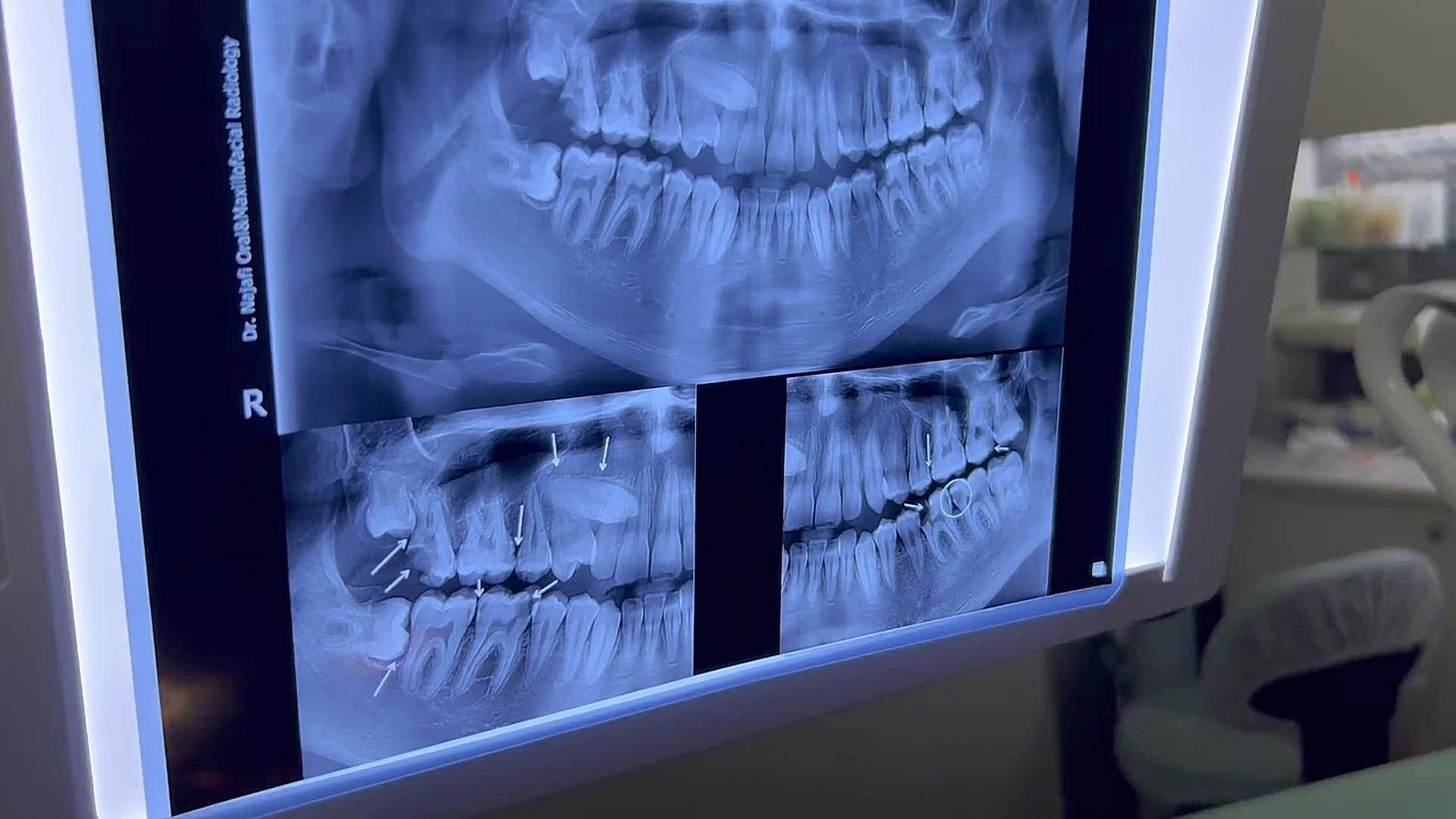 ارتودنسی دكتر مهدي فهيمي هنزائي