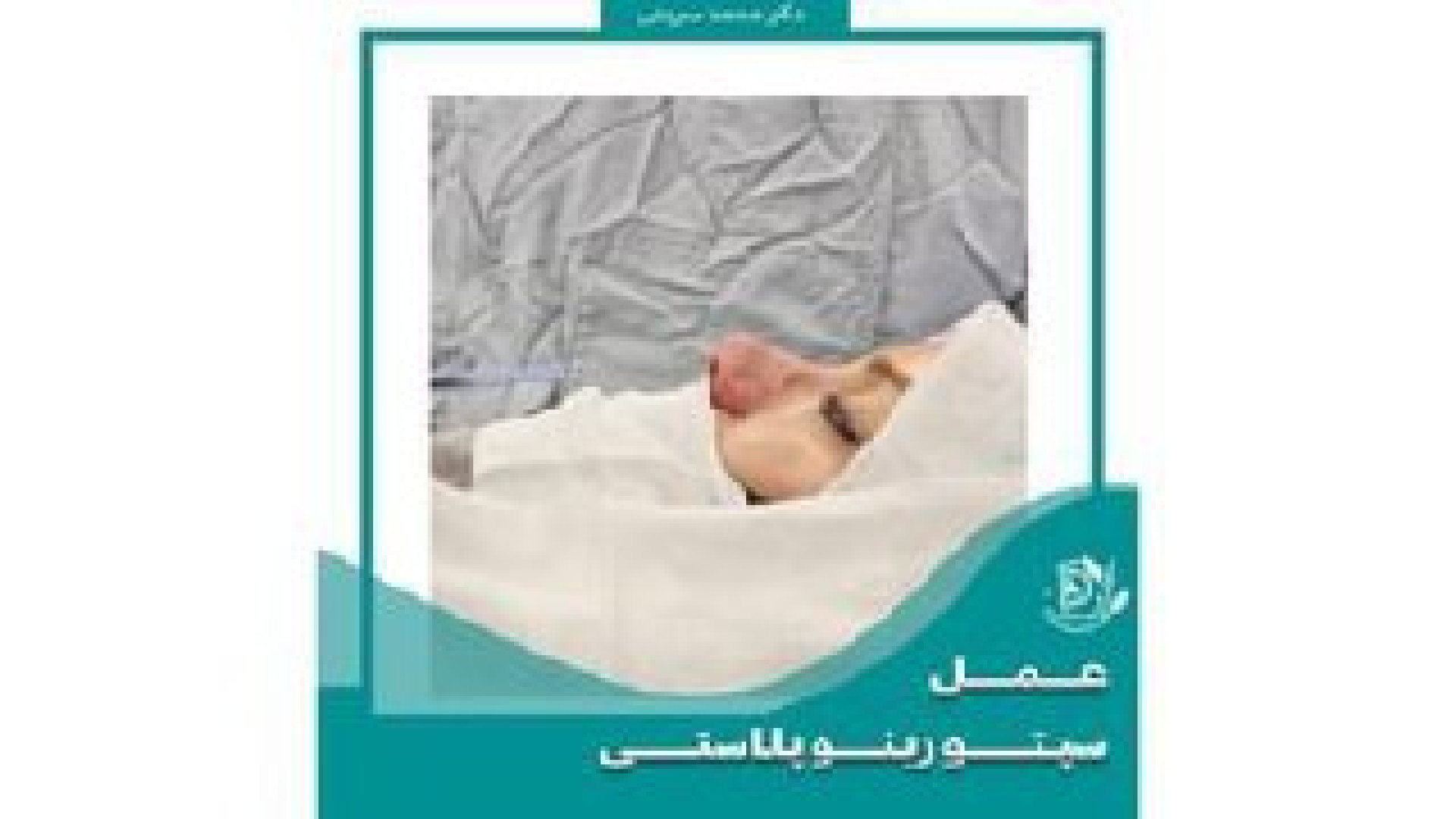 عمل فوق العاده بینی دکتر محمد سروش