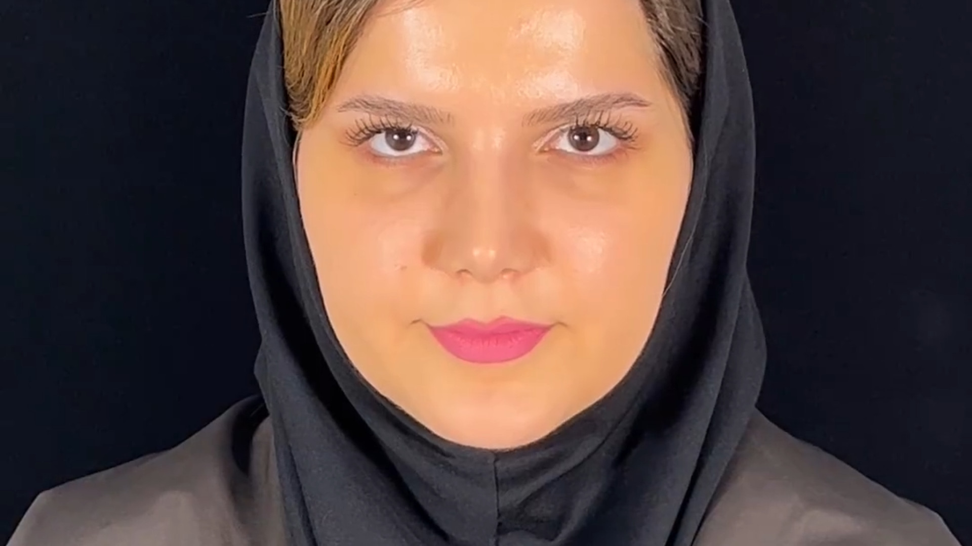 نمونه کار جراحی بینی توسط دکتر مهدی بنایی