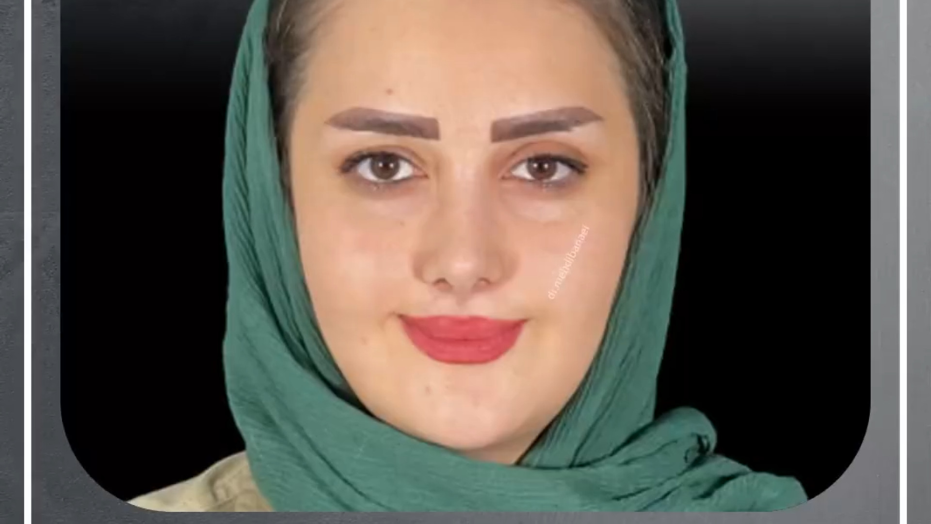 نتیجه جراحی زیبایی بینی