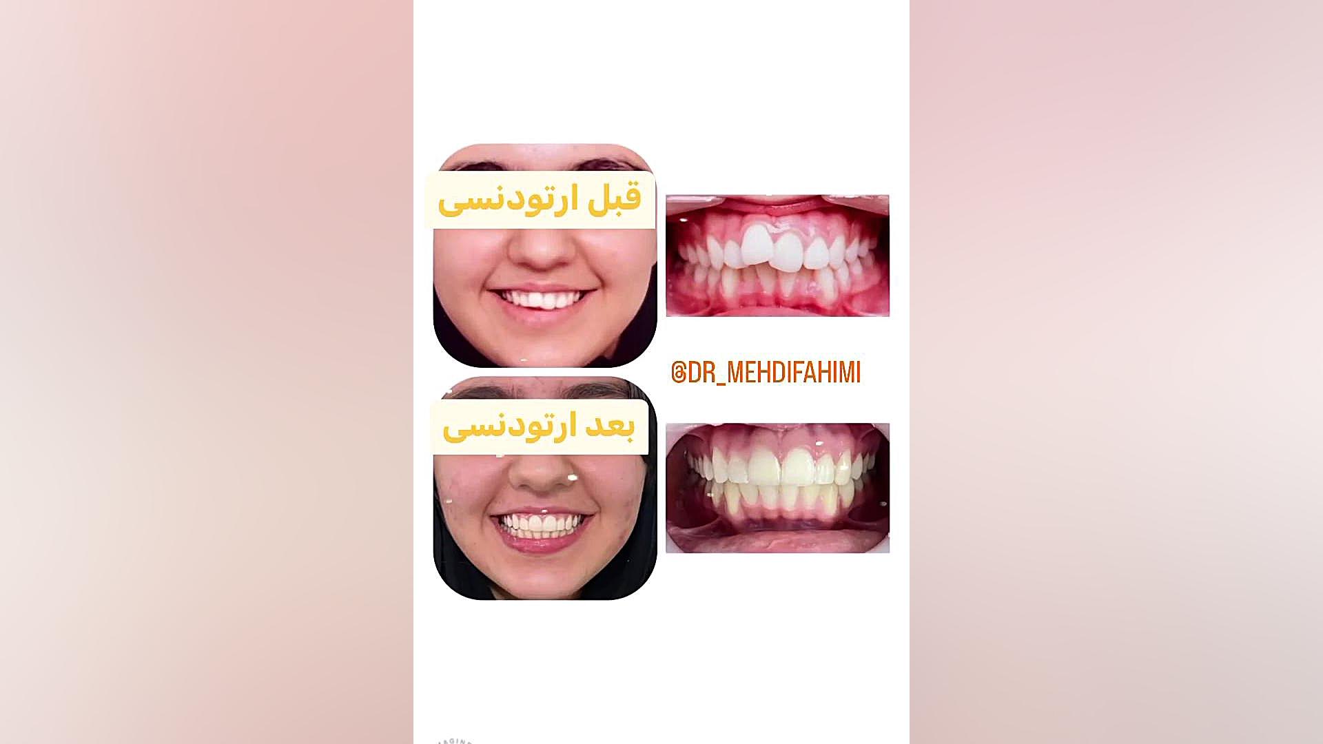 ارتدنسی دكتر مهدي فهيمي هنزائي