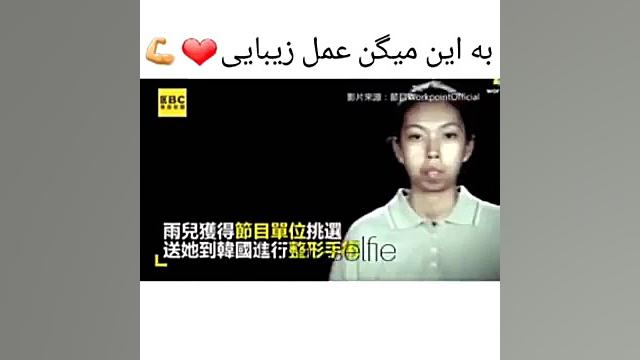 به این میگن عمل زیبایی ایمپلنت مغز-ماشین