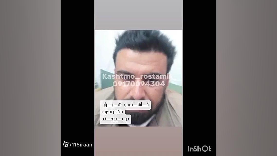 کلینیک کاشت مو دکتر شبان در بیرجند جراحی لثه