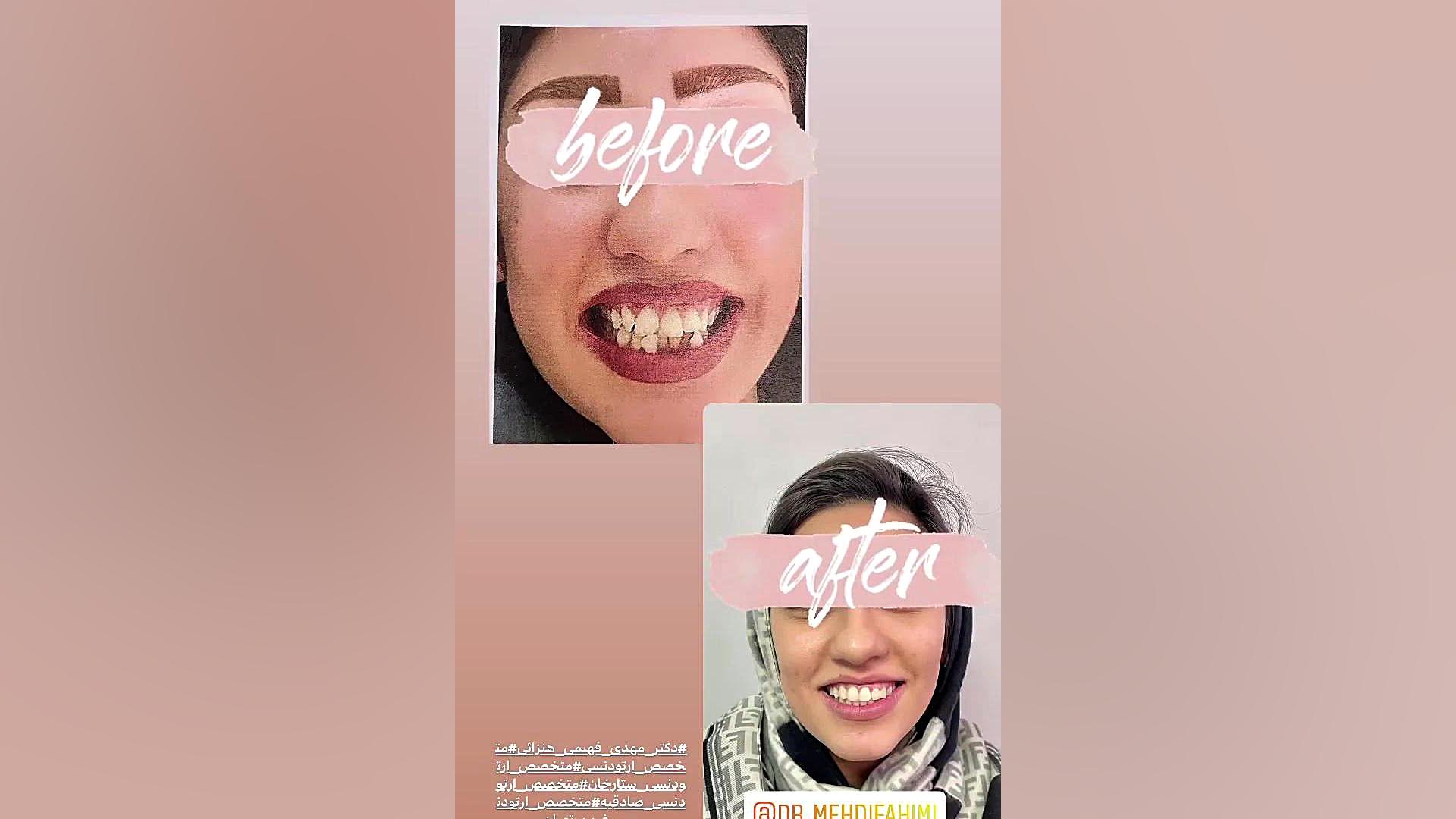 ارتودنسی دکتر مهدی فهیمی هنزائی دكتر مهدي فهيمي هنزائي