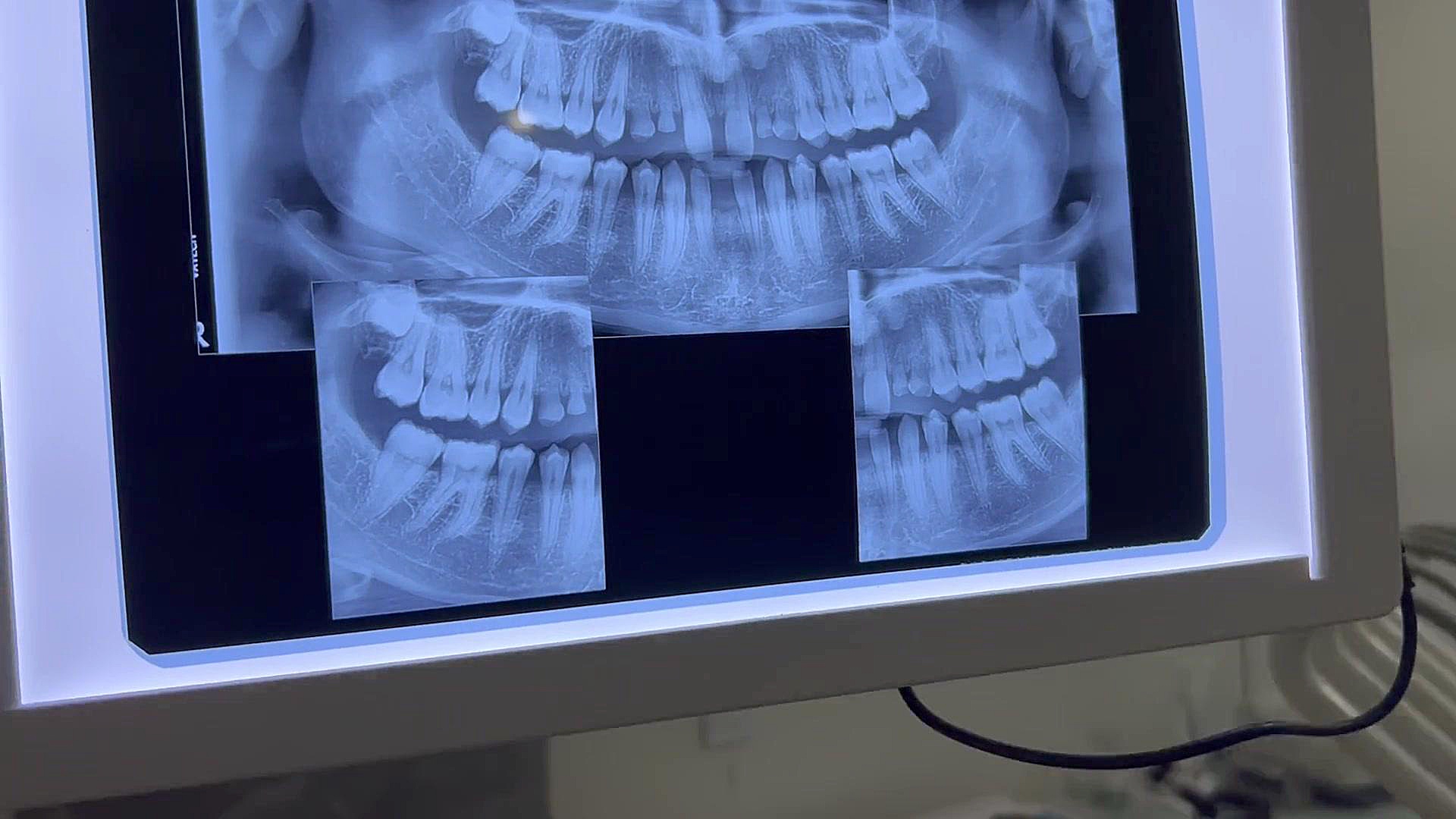 ارتودنسی دکتر مهدی فهیمی هنزائی دكتر مهدي فهيمي هنزائي